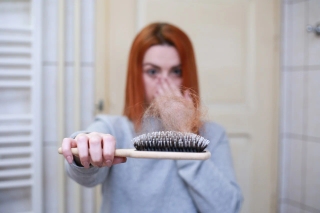 What is hair loss? How to prevent it?