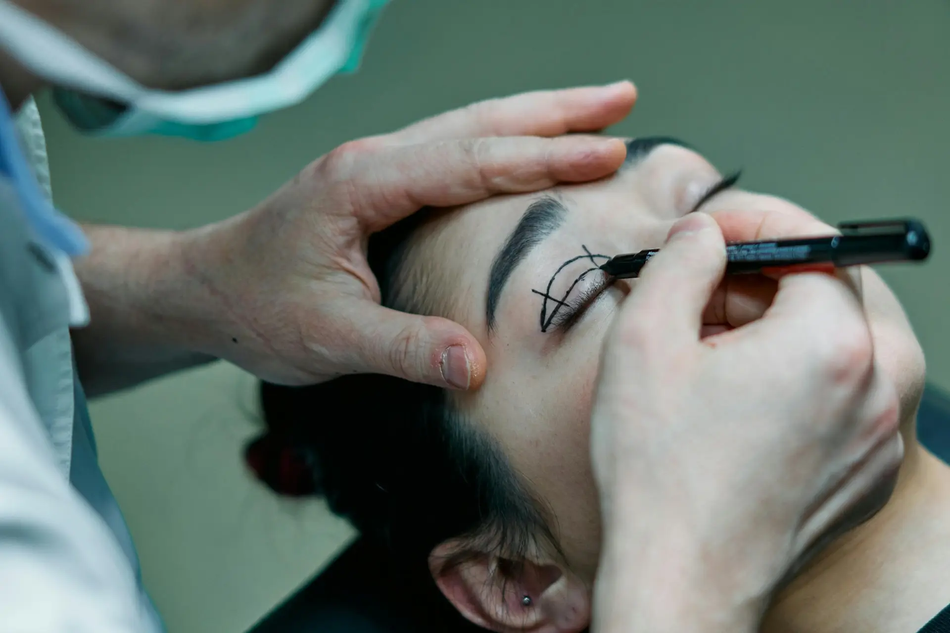 Eyelid marking for plastic surgery operation