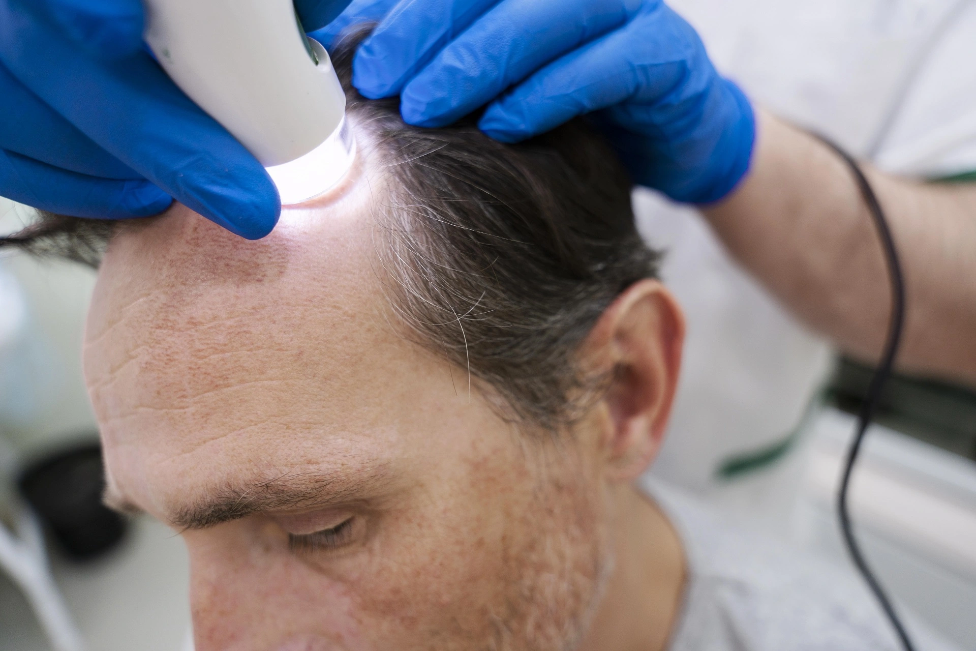 Man getting hair loss treatment