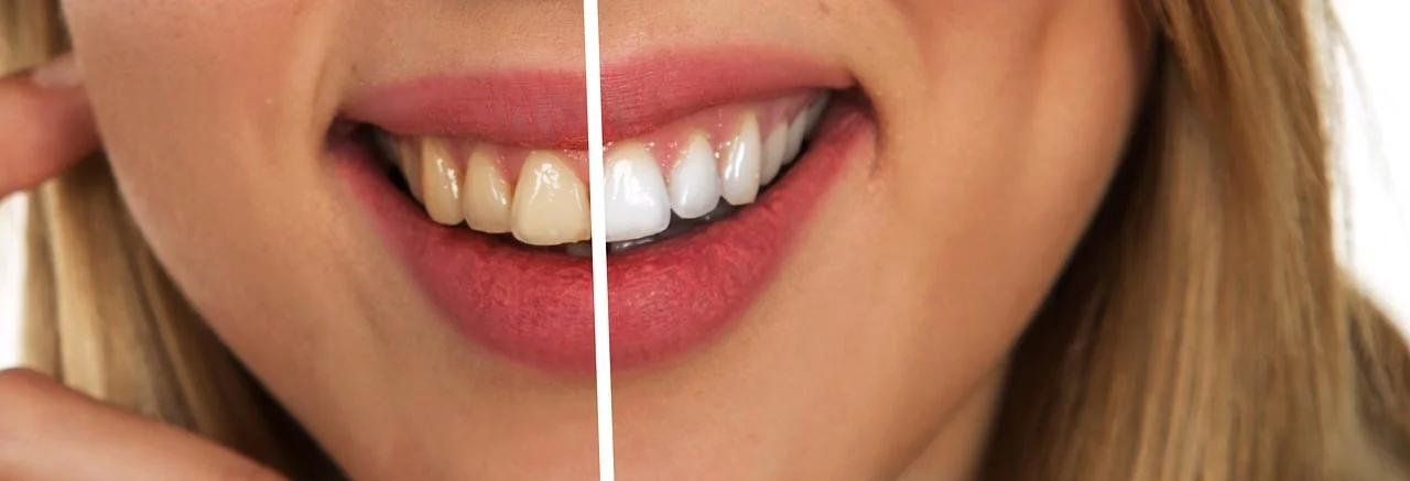 Dental beautiful smile with health tourism